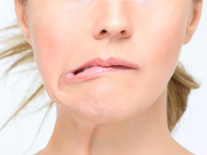 فیزیوتراپی صورت در منزل