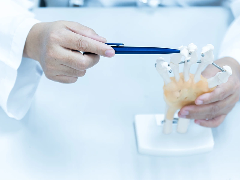 فیزیوتراپی انگشتان دست در منزل